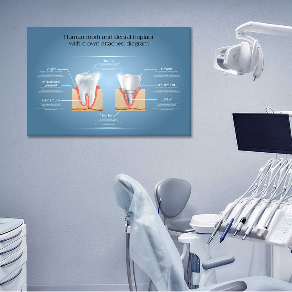 Tooth Shaped Picture Frame | Dental Picture Frame - Framer.pk