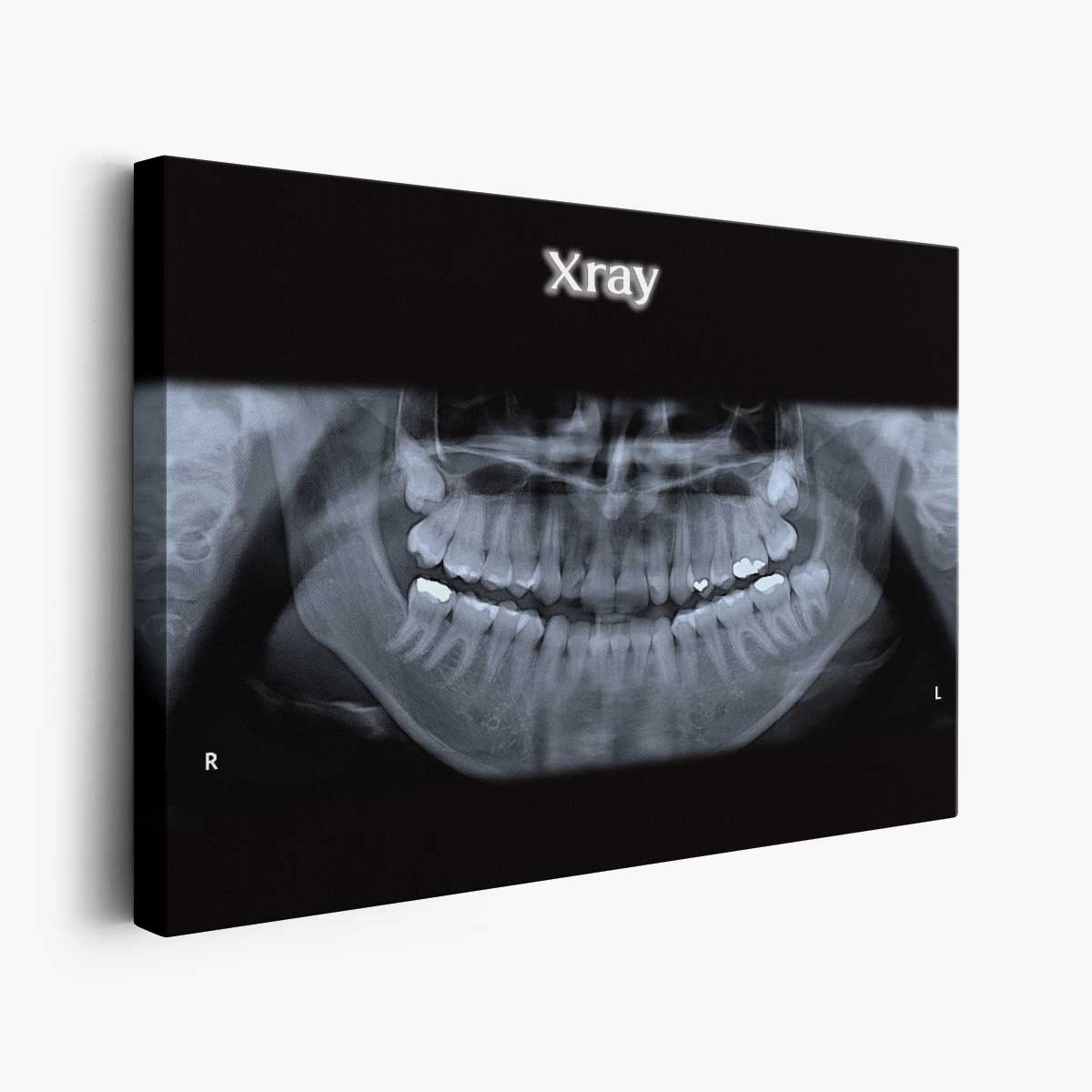 Dental X Ray – Framer